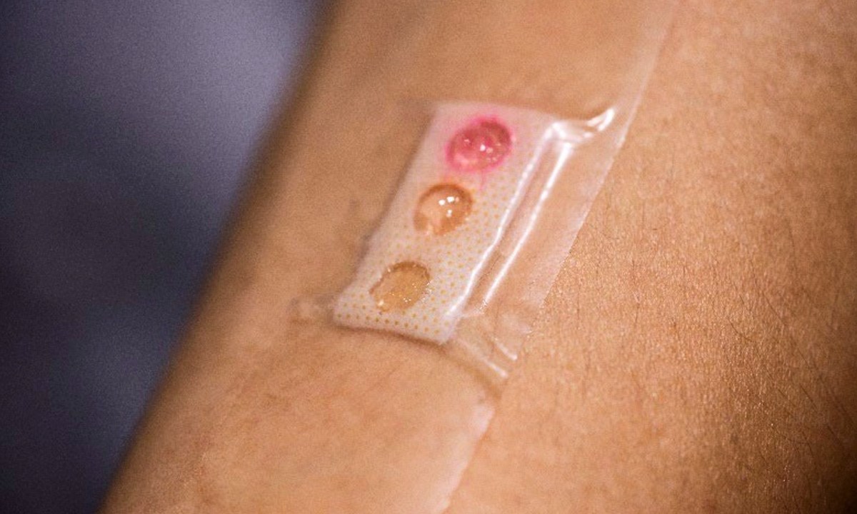 Sweat analysis smart patch.