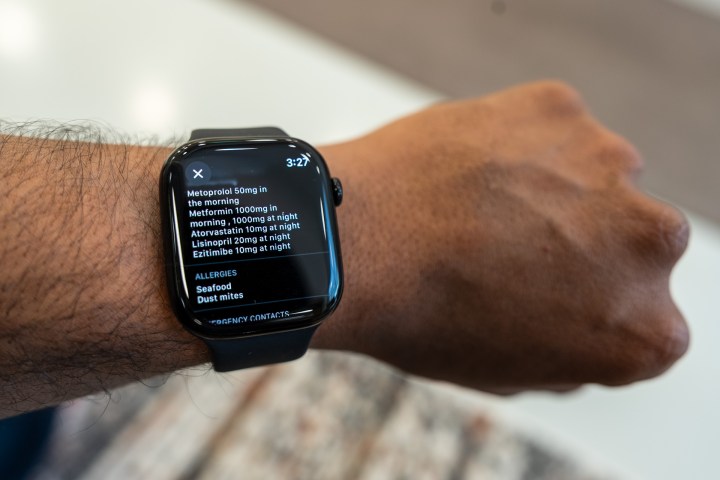 Medical ID allergies on Apple Watch Series 10 strapped to a person's hand.